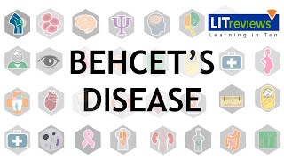 Behcets Disease [upl. by Liba]