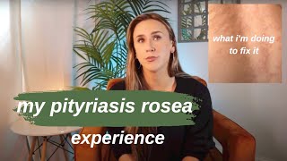 My Pityriasis Rosea Experience  Symptoms Healing Next Steps [upl. by Yoccm]