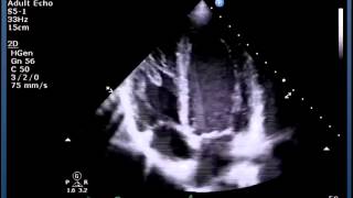 Understanding Echo Standard Imaging Views [upl. by Poppas400]