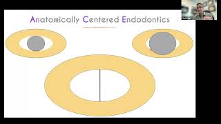 CE Webinar Anatomically Centered Endodontics with Dr Chafic Safi [upl. by Arlo]