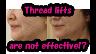 A must see video for those who think “thread lifts have no effect” Part 2 Shortened version [upl. by Mukul]