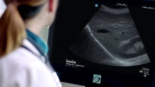 Introducing the Sonosite XPorte Kiosk Ultrasound System [upl. by Madai]