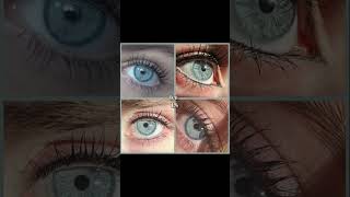 How rare is your eye colour🤔👀 glowup eyes shortvideo fyp [upl. by Nyraa334]