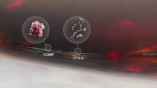 Pentosan polysulfate sodium PPS potential mechanism of action in osteoarthritis [upl. by Redwine985]