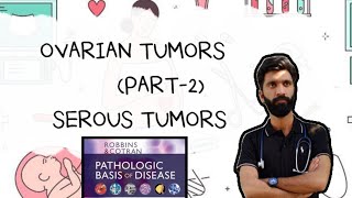 OVARIAN TUMORS PART2 PATHOLOGY ROBBINS BASIS [upl. by Ecenahs]