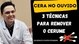 Retirando a Cera de Ouvido com um Jato dágua [upl. by Nueoht336]