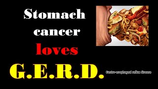 Stomach cancer loves G E R D [upl. by Shellans]