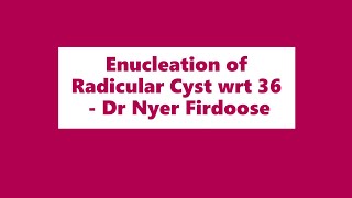 Enucleation of Radicular Cyst wrt 36  Dr Nyer Firdoose [upl. by Flanagan102]