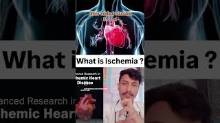 What is ischemia by M kumar [upl. by Selinski]