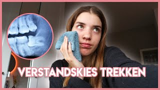 Mijn VERSTANDSKIES Laten TREKKEN Muffins BAKKEN ☆ Weekvlog 7  Zenne Bakens [upl. by Orteip805]