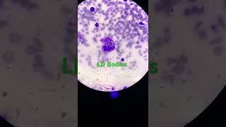 LD body  Leishmaniasis  Slide  Blood  Peripheral Smear [upl. by Moser318]