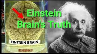 The Shocking Truth About Albert Einsteins Brain yt alberteinstein informationstation18 genius [upl. by Poole]