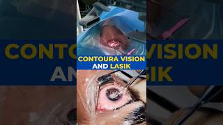 Contoura Vision And Lasik Surgery [upl. by Artened]