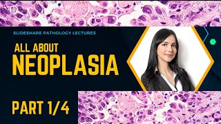 All About Neoplasia  From Beginners to Pro in diagnosis  Part 14 [upl. by Eceinej163]