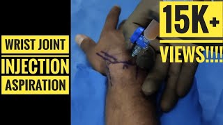 Wrist InjectionAspiration Technique [upl. by Ahcire]