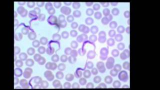 Trypanosoma Chagas [upl. by Chiquita]