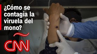 ¿Cómo se contagia la viruela del mono mpox que fue declarada emergencia internacional por la OMS [upl. by Snook]