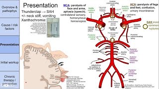 Stroke cerebrovascular accident CVA [upl. by Roath]