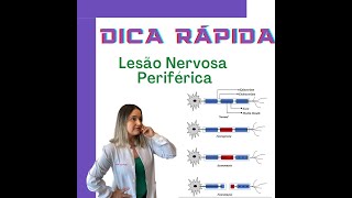 DICA RÁPIDA  LESÃO NERVOSA PERIFÉRICA [upl. by Bergren]