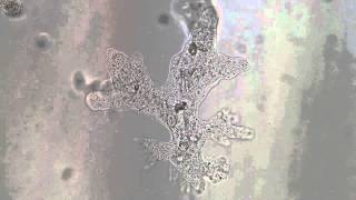 Amoeba proteus  Full HD video  Brightfield microscope [upl. by Symer]