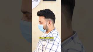 Hair loss treatment for men Hair loss solution for men Hair fall treatment [upl. by Shreeves981]