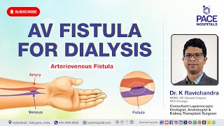 AV Fistula Surgery  AV Fistula for Dialysis  Procedure Uses Benefits amp Complications [upl. by Schaaff]