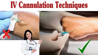 How To Insert IV Cannula  IV Cannulation Techniques [upl. by Nwahsar]