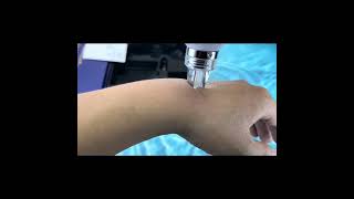 MesoGun crystalline Nano Infusion RF EMS Skin Injector Mesotherapy beauty center [upl. by Ebbarta]