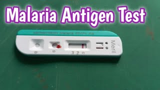 Malaria Antigen Test  How to Perform Malaria Antigen Test [upl. by Day]