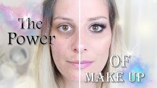 Le pouvoir du maquillage acné cicatrices cernes [upl. by Queen]