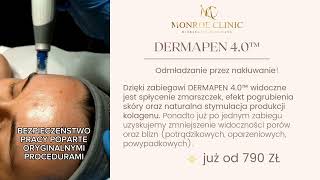 ZABIEG DERMAPEN 40 MONROE CLINIC KIELCE [upl. by Marena708]