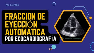 ✅FRACCIÓN DE EYECCIÓN AUTOMÁTICA por Ecocardiografía PASO A PASO🕥 [upl. by Namra]