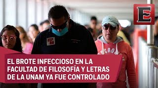 Secretaría de Salud prevé 5 mil casos de paperas en el país [upl. by Eph91]