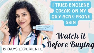 I tried emolene cream on my oily acneprone skin  Detailed review with all kinds of experiments [upl. by Cattima]