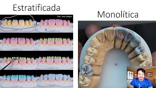 Cerâmicas Odontológicas parte 35 [upl. by Nnhoj]