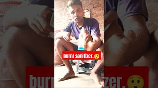 burnt sanitizer😲theyadavbhai02amazing experiment magic science entertainment [upl. by Adnahc83]