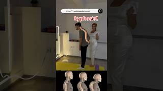 Try these kyphosis exercises to relieve pain and improve posture KyphosisRelief kyphosis [upl. by Rosemare]