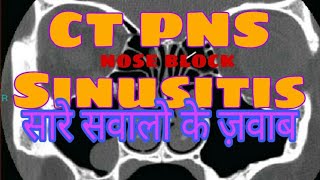 CT Scan PNS Sinusitis in Hindi  by Radiographer Guruji [upl. by Roeser]