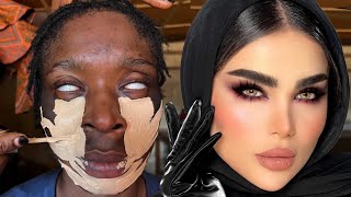 A Blind Girl Got Transformed Into This 😳👆🔥Unbelievable Makeup Transformation 🔥💉😳🔥😱 Makeup Tutorial [upl. by Terrag]