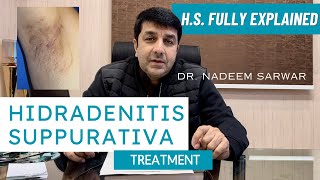 HS Hidradenitis Suppurativa Homeopathic Medicines and Treatment Explained  Dr Nadeem Sarwar [upl. by Acilegna]