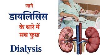 Dialysis types time benefits amp complication  जाने डायलिसिस के बारे में सब कुछ [upl. by Yemarej665]