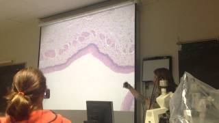 nonkeratinized stratified squamous epithelia in esophagus [upl. by Aurthur]