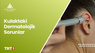 Kulaktaki Dermatolojik Sorunlar [upl. by Amador]