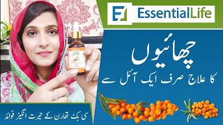 Sea Buckthorn Fruit Oil  سی بُو  OMEGA 7 OIL Benefits How To Use  Chiltan Pure URDU [upl. by Linda]