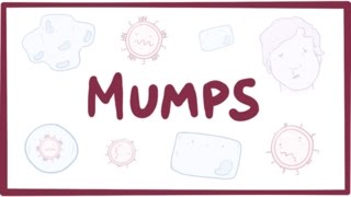 Mumps  symptoms diagnosis treatment pathology [upl. by Fillender]