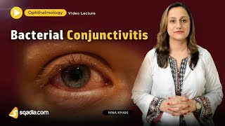 Bacterial Conjunctivitis  Ophthalmology Video Lecture  Medical Student VLearning [upl. by Onavlis]