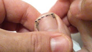 Tuto Comment bien se couper les ongles de pied pour éviter tout ongle incarné manière technique [upl. by Ahcorb]