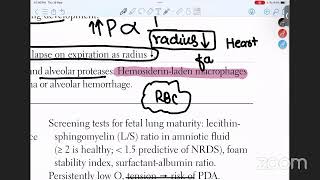 Respiratory System 1st Trial class [upl. by Oiramat221]