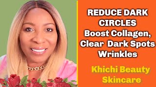 Skincare Tips For Dark Circles Wrinkles Collagen and Dark Spots [upl. by Akinnej839]