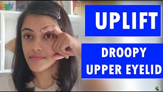 HOW TO LIFT DROOPY EYELIDS NATURALLY  HOW TO FIX DROOPY EYELIDS NATURALLY  EYELIFTING EXERCISES [upl. by Raynard]